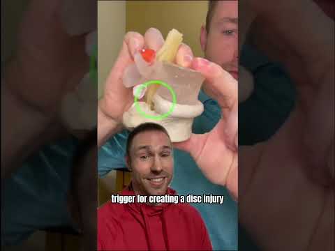 How to Fix a Disc Bulge (WITHOUT SURGERY)