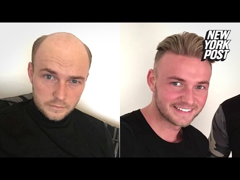 Bald Guys Are Wigging Out for These Believable Hairpieces from Quiff and Co. | New York Post