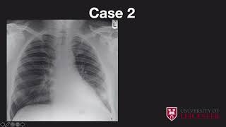 Chest x-ray case review