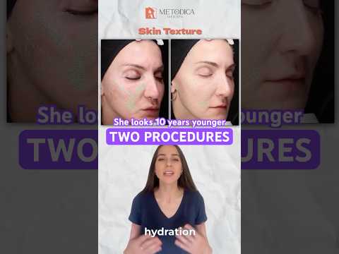 How My Skin Got YOUNGER After 50 With This Secret Method?