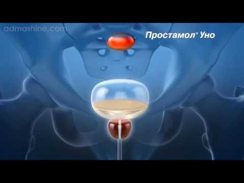 Гимнастика при конгестивном простатите