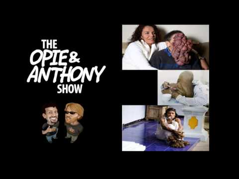 Opie and Anthony: Tumor Face (02/07/2008)