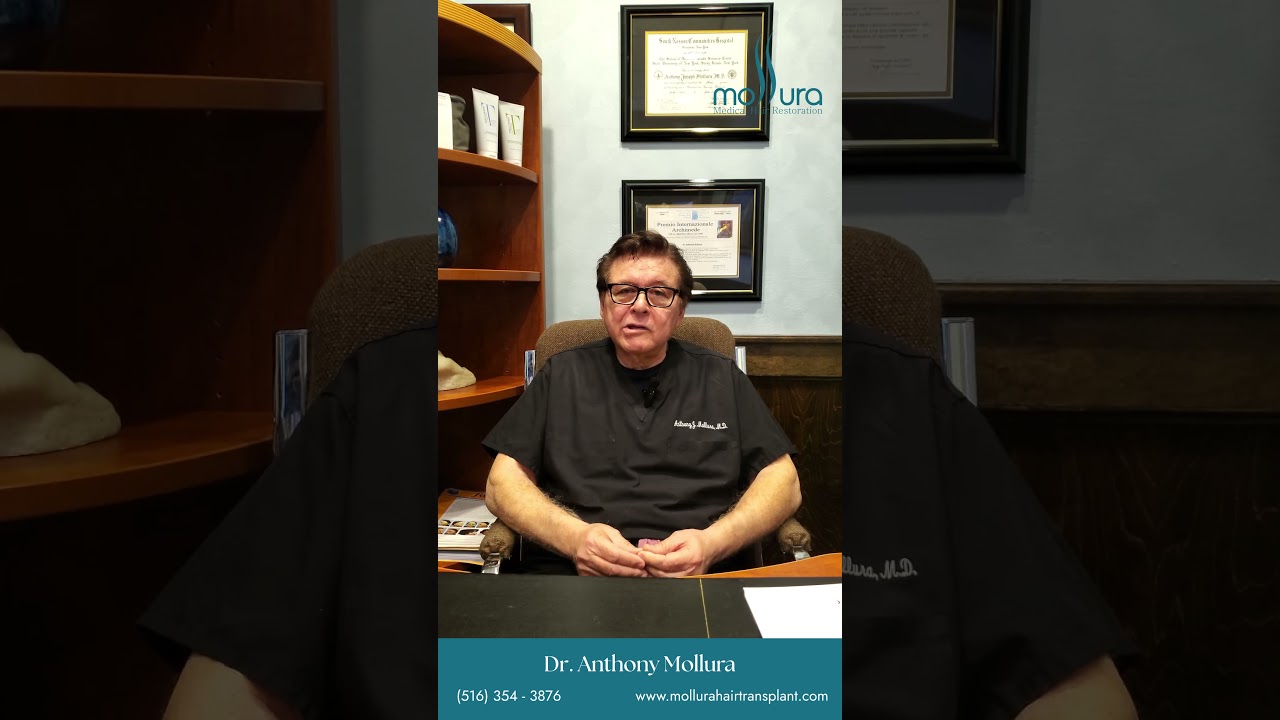 Is a hair transplant permanent?