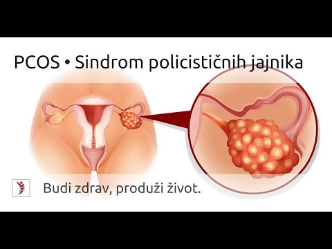 Kako smanjiti pritisak bez lijekova kod kuće - Dijagnostika - February