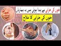 Khoon Ki Kharabi Se Paida Hoti Hain Yeh Bemariyan L Khoon Ki Kharabi Ka Ilaj