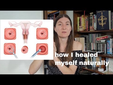 How I Healed Myself from HPV and Cervical Dysplasia CIN 2 (High Grade)