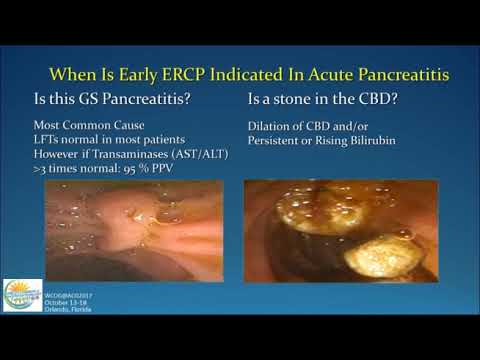 Management of Acute Pancreatitis