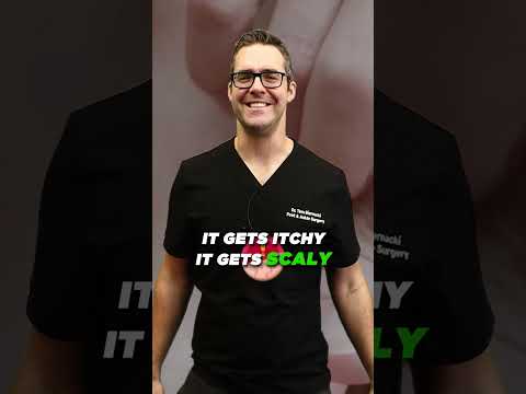 Best Wound Care Centers in Michigan Skin Diabetic Foot Ulcers