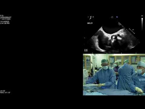 SZMC ShortCut ICI 2022