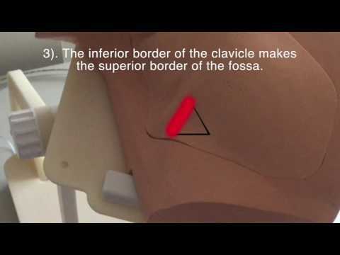 Central Vascular Access Subclavian Technique
