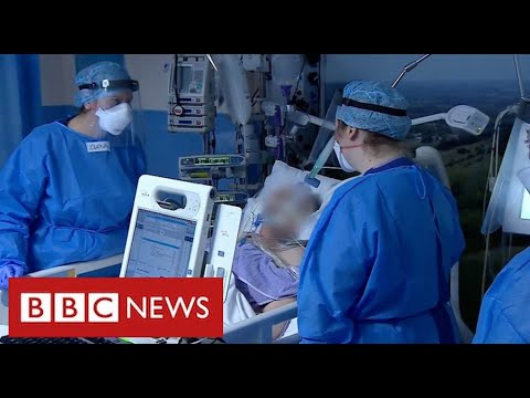 NHS上司警告說，英國Covid病例激增，壓力巨大 - BBC新聞網 (NHS leaders warn of intense pressure as Covid cases surge across UK - BBC News)