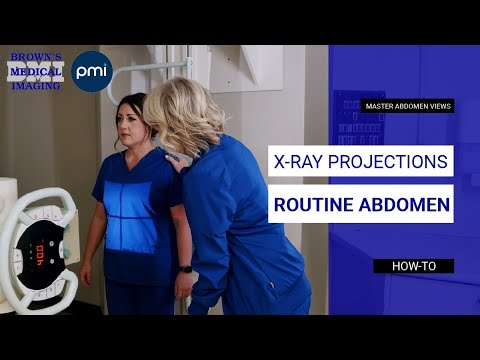 How to Position for Routine Abdomen X-Ray Projections