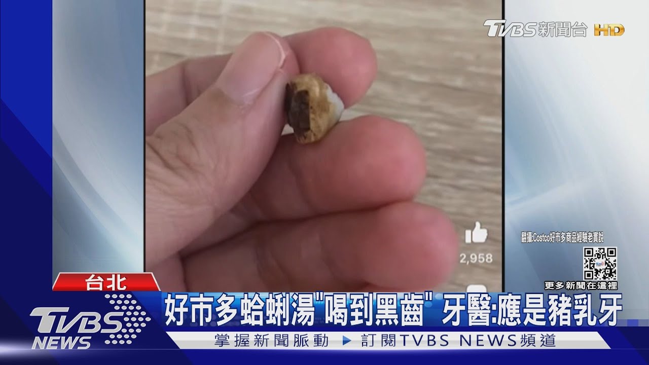 好市多蛤蜊湯「喝到黑齒」 牙醫:應是豬乳牙