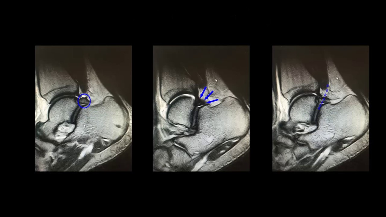 David Alberto Bayona Luna-11