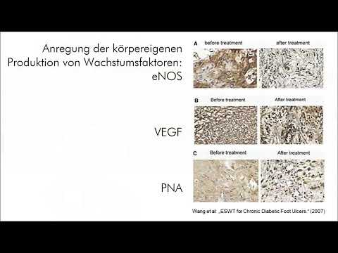 Avodart Behandlung von Prostatitis und Omnicom Prostatitis und die Folgen, dass diese