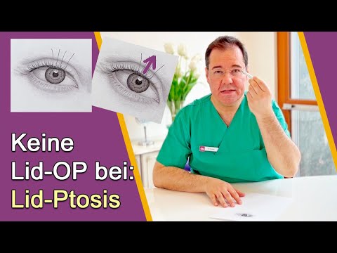 Augenlid-OP – Kontraindikation Lid-Ptosis - hier ist eine Lid-OP keine gute Idee