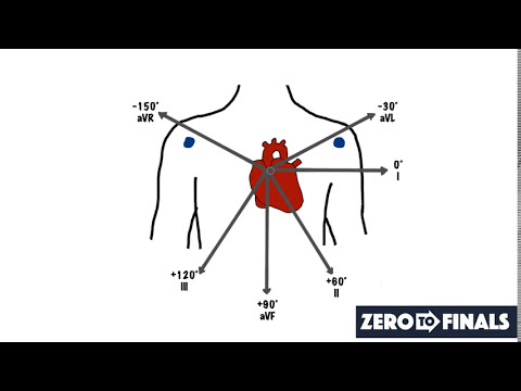 Understanding ECG Axis and Axis Deviation