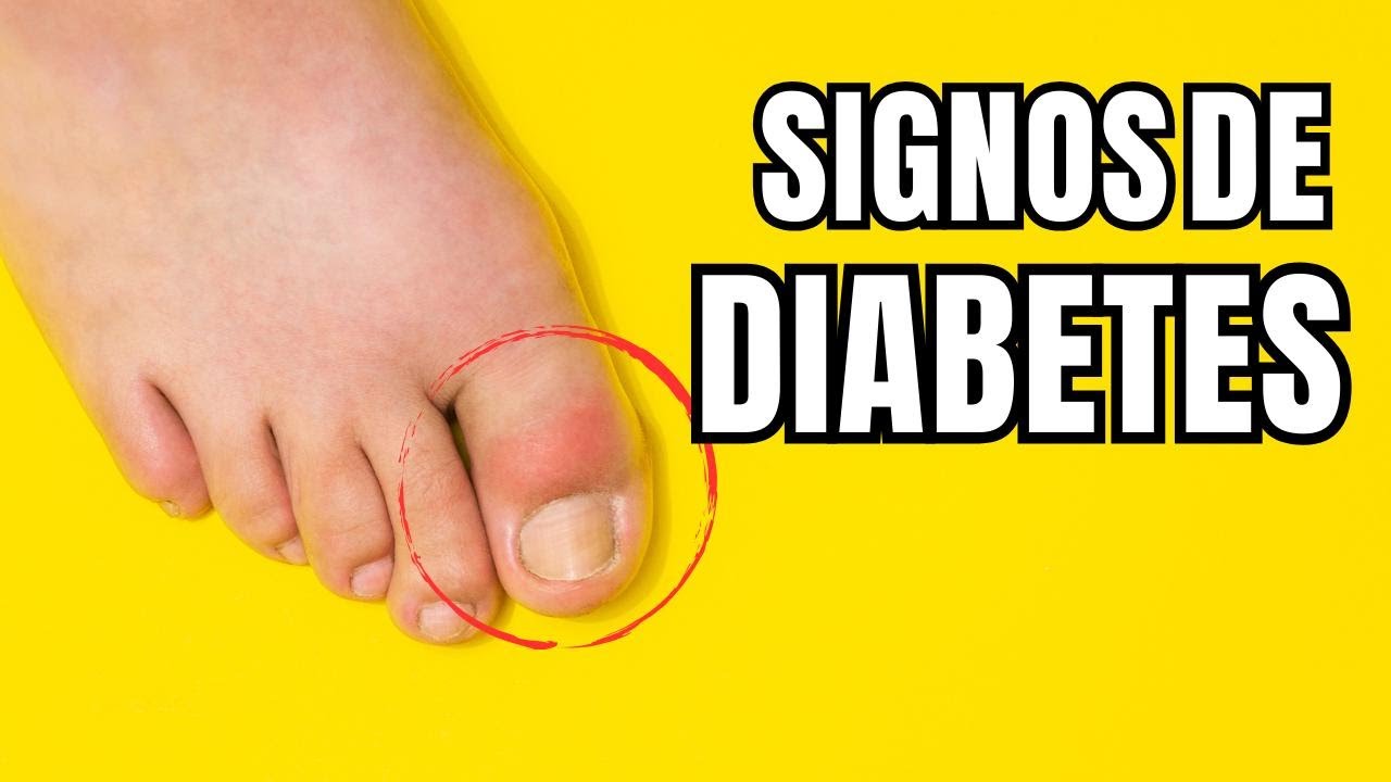 ¡Cuidado! 7 Señales Peligrosas de la Diabetes Explicadas por un Médico