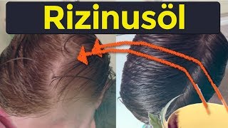 Wie man Kahlheit mit Rizinusöl verhindert - Stoppt Haarausfall mit Rizinusöl