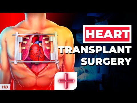 Myocardial Infarction Causes Signs and Symptoms Diagnosis and Treatment