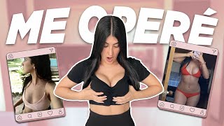 Lo que NO ME DIJERON antes de mi CIRUGÍA DE SENOS 🍒 | ¿ME ARREPIENTO 😰