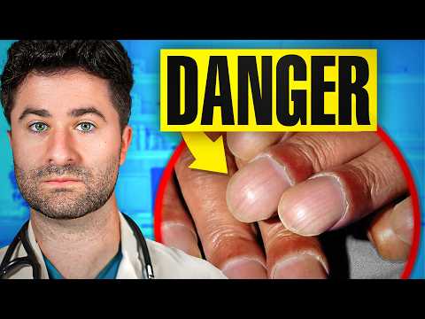 What Your NAILS Say About Your HEALTH: Doctor Explains