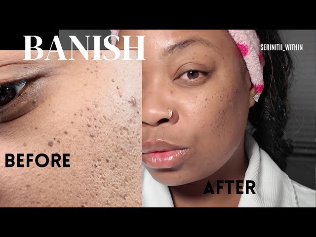 Judge.me YouTube video placeholder