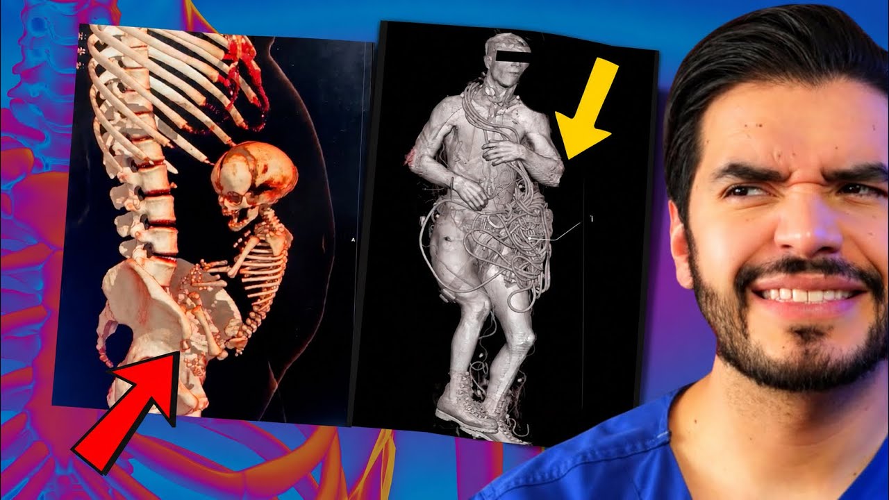 🚨Los RAYOS X MÁS RAROS y MISTERIOS MÉDICOS | DOCTOR VIC