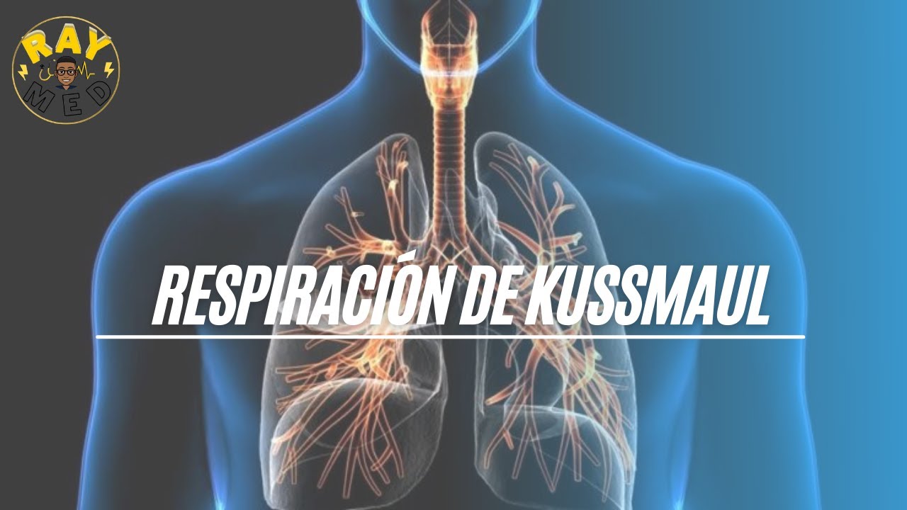 ¿Cuál es la razón por la que se producen las respiraciones de Kussmaul en la cetoacidosis diabética?