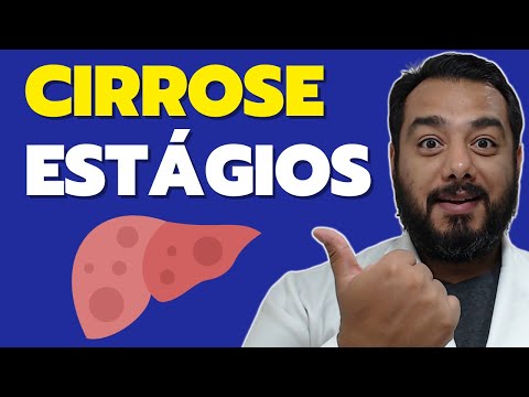 Stages of Liver Cirrhosis: Discover How to Identify if the Disease is Advanced!