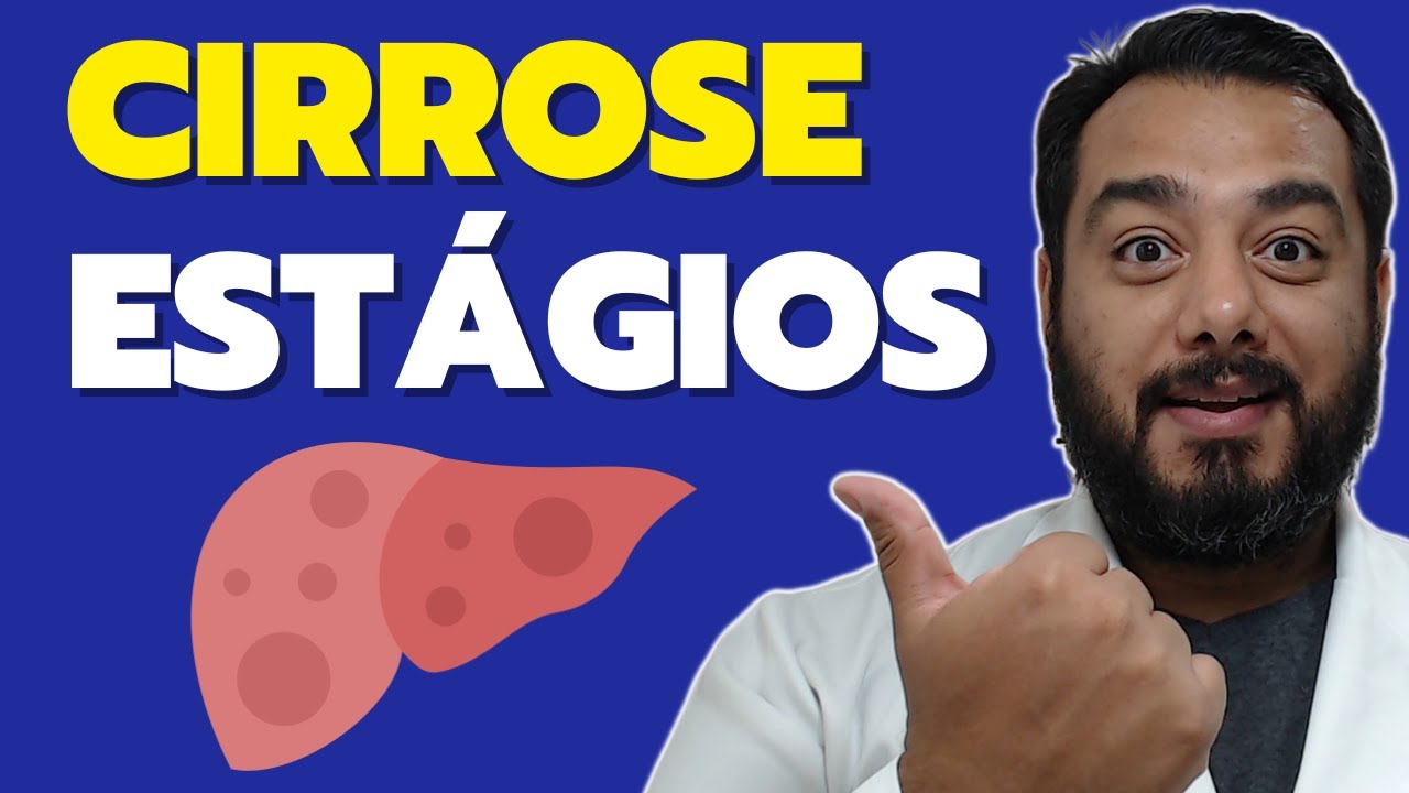 Estágios da Cirrose Hepática: Descubra como Identificar se a Doença está Avançada!
