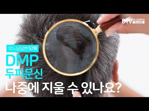 의느님답변????ㅣ의느님답변 57회 두피문신(DMP) 지울 수 있나요? 민머리 두피문신 후 염색해도 되나요?