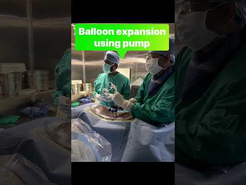Vertebroplasty by Dr. Prashanth Alle
