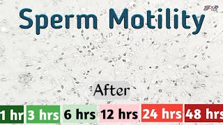 Sperm motility after 1 hour to 48 hours in semen  sample | sperm | semen | sperm motility ||