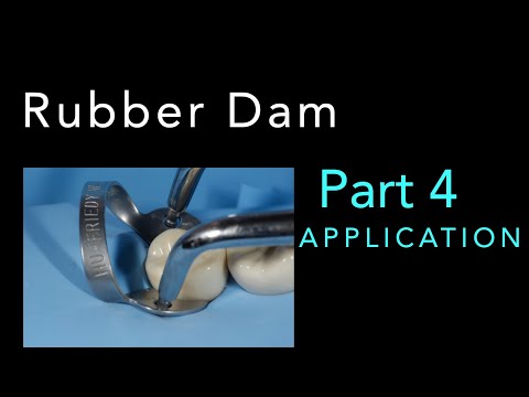 Rubber Dam - PART 4: Application