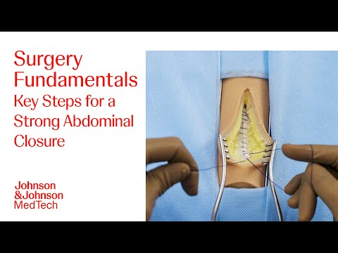 Abdominal Closure Technique | Foundational Surgical Skills with Dr. Eham Arora | J&J MedTech