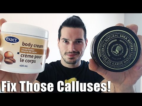 How to Treat Calluses from Weight Lifting & Working Out Video