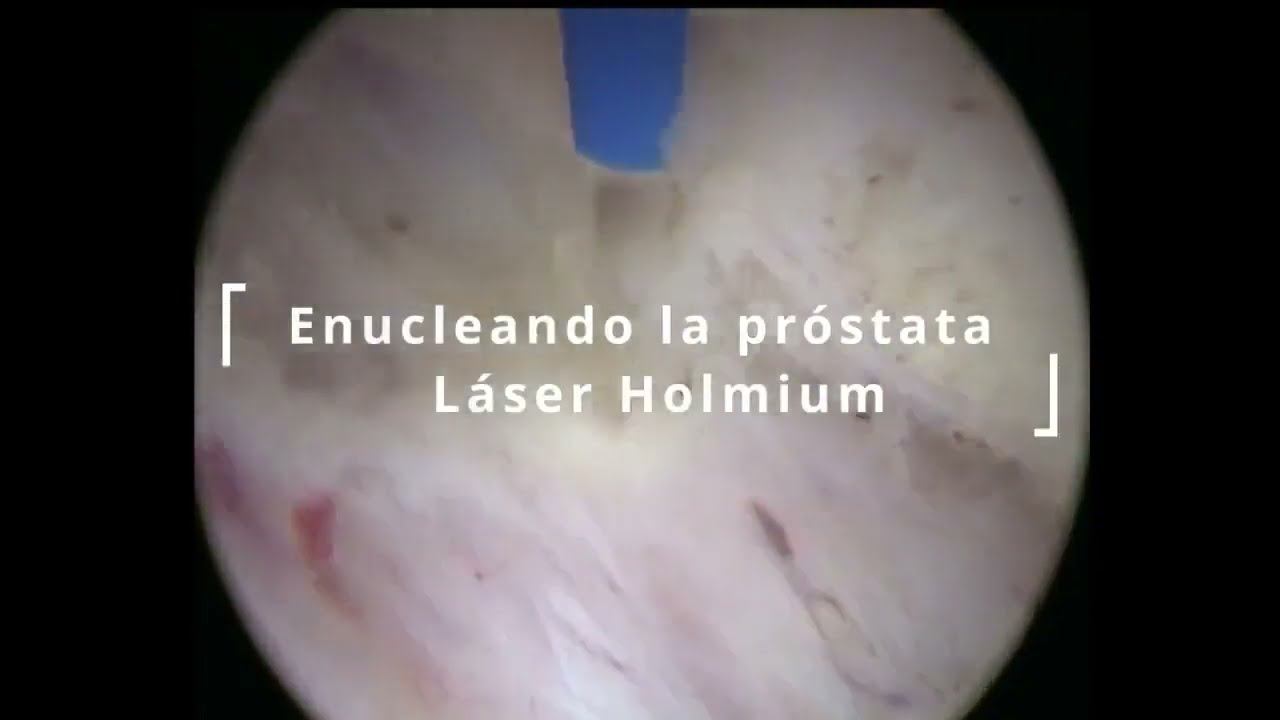 Alfonso Albella Amigo-6