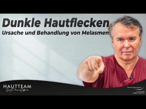Melasma - Hautflecken den Kampf ansagen