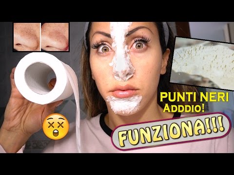 Come chiamano lattrice rossa con lentiggini I migliori rimedi di gente da pigmentazione su una faccia