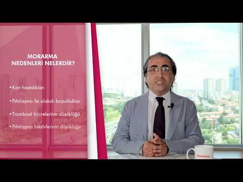 Morarma nedir ve nedenleri nelerdir? 