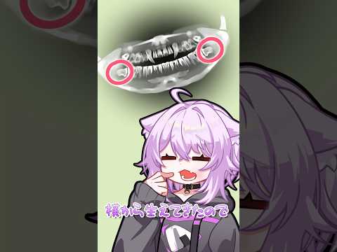 🦷🦷🦷 #vtuber  #shorts  #猫又おかゆ  #親知らず  #歯医者 thumbnail
