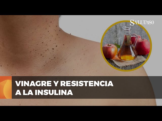 Youtube Imagen