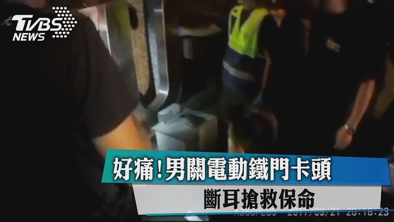 好痛!男關電動鐵門卡頭 斷耳搶救保命