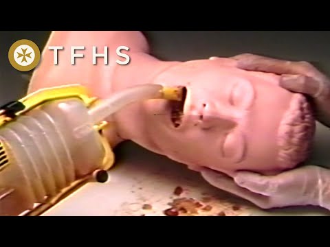 VVAC Hand-powered Suction Unit (1989)