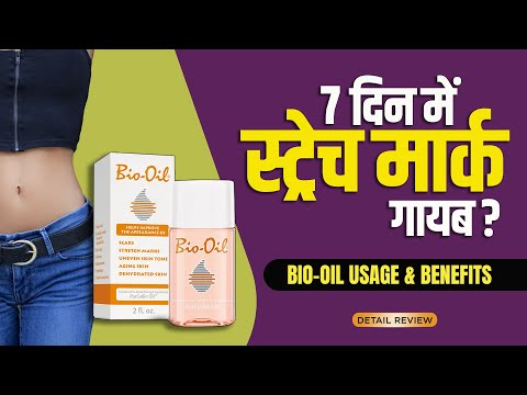 Bio oil for stretch marks | How to use bio oil | Detail review in hindi by Dr.Mayur