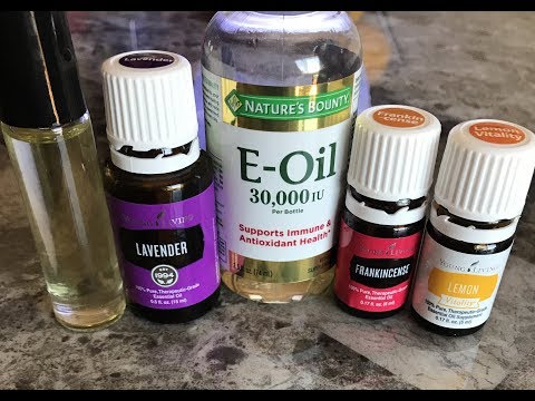 download lagu mp3 mp4 Lavender Under Eyes, download lagu Lavender Under Eyes gratis, unduh video klip Lavender Under Eyes