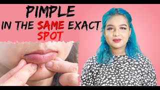 Episode 7: Pimple in the exact same spot | The Mall