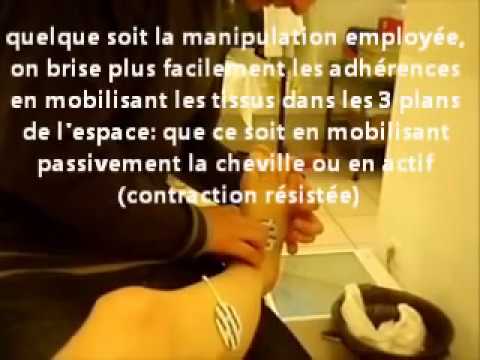 comment soulager douleur ligamentaire enceinte