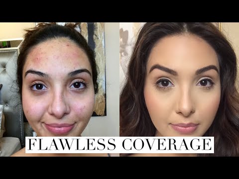 How to Cover Acne Breakouts & Dark Spots with Makeup